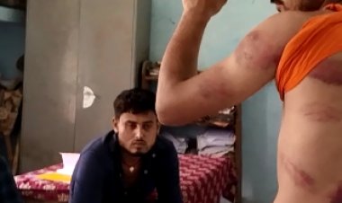 बिहार के मुजफ्फरपुर में जदयू नेता की दबंगई। तीन लोगों की बेरहमी किया पिटाई, दो लोग के उखाड़े नाखून, आरोपी गजनफर हुसैन को पुलिस ने किया गिरफ्तार