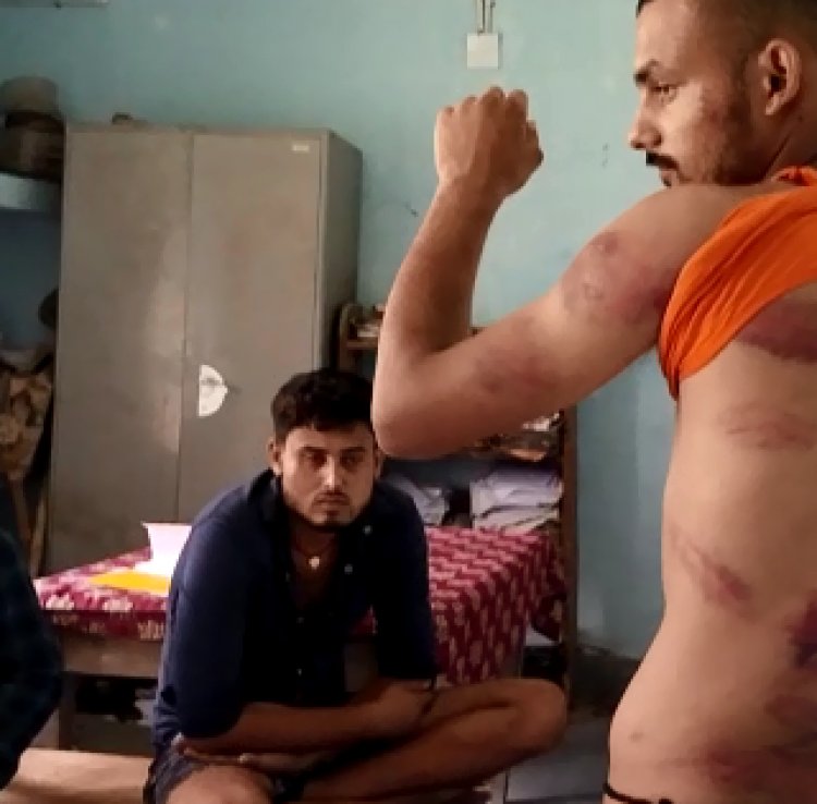 बिहार के मुजफ्फरपुर में जदयू नेता की दबंगई। तीन लोगों की बेरहमी किया पिटाई, दो लोग के उखाड़े नाखून, आरोपी गजनफर हुसैन को पुलिस ने किया गिरफ्तार